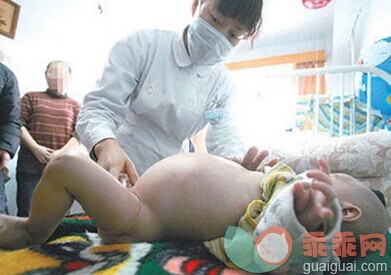 孕妇产下“胎中胎” 女婴随后接受2小时手术