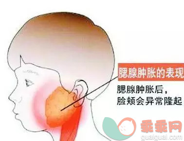 小儿流行性腮腺炎防治知识