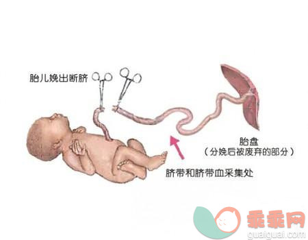 新生儿脐带血有什么作用？需要保存吗