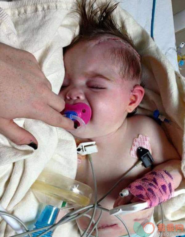 8个月婴儿被亲生父亲剧烈摇晃后 致脑部损伤