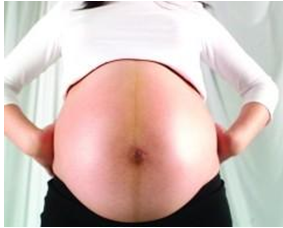 孕妇肚子中间有一条黑线是什么？