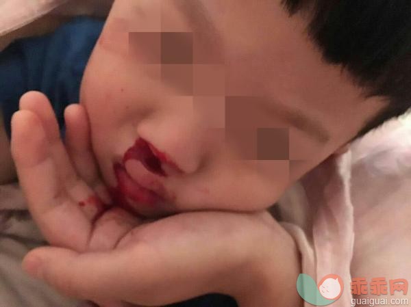 疑因塑胶操场有毒 上海一幼儿园孩子流鼻血