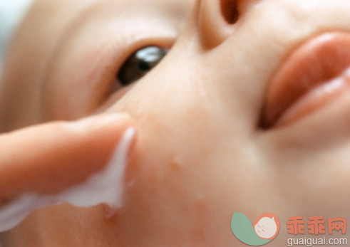 宝宝长粟粒疹的原因和治疗方法