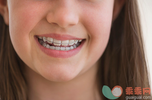 人,吊带,影棚拍摄,人的脸部,嘴唇_525445465_Girl (10-11) wearing dental braces smiling_创意图片_Getty Images China