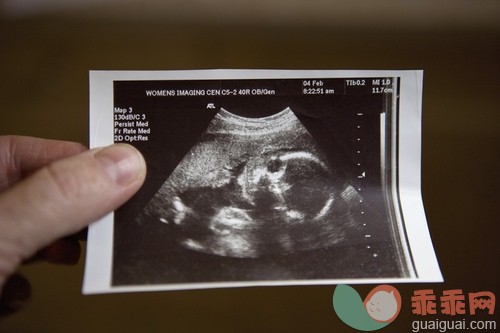 城市,白昼,出示,文档,女性生殖系统_gic14763781_Ultrasound of a human fetus_创意图片_Getty Images China