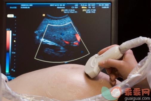 人,人生大事,健康保健,室内,中间部分_80567476_A woman having an ultrasound scan_创意图片_Getty Images China