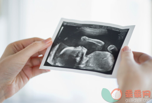 人,健康保健,室内,手,怀孕_98033162_woman holding ultrasound image_创意图片_Getty Images China